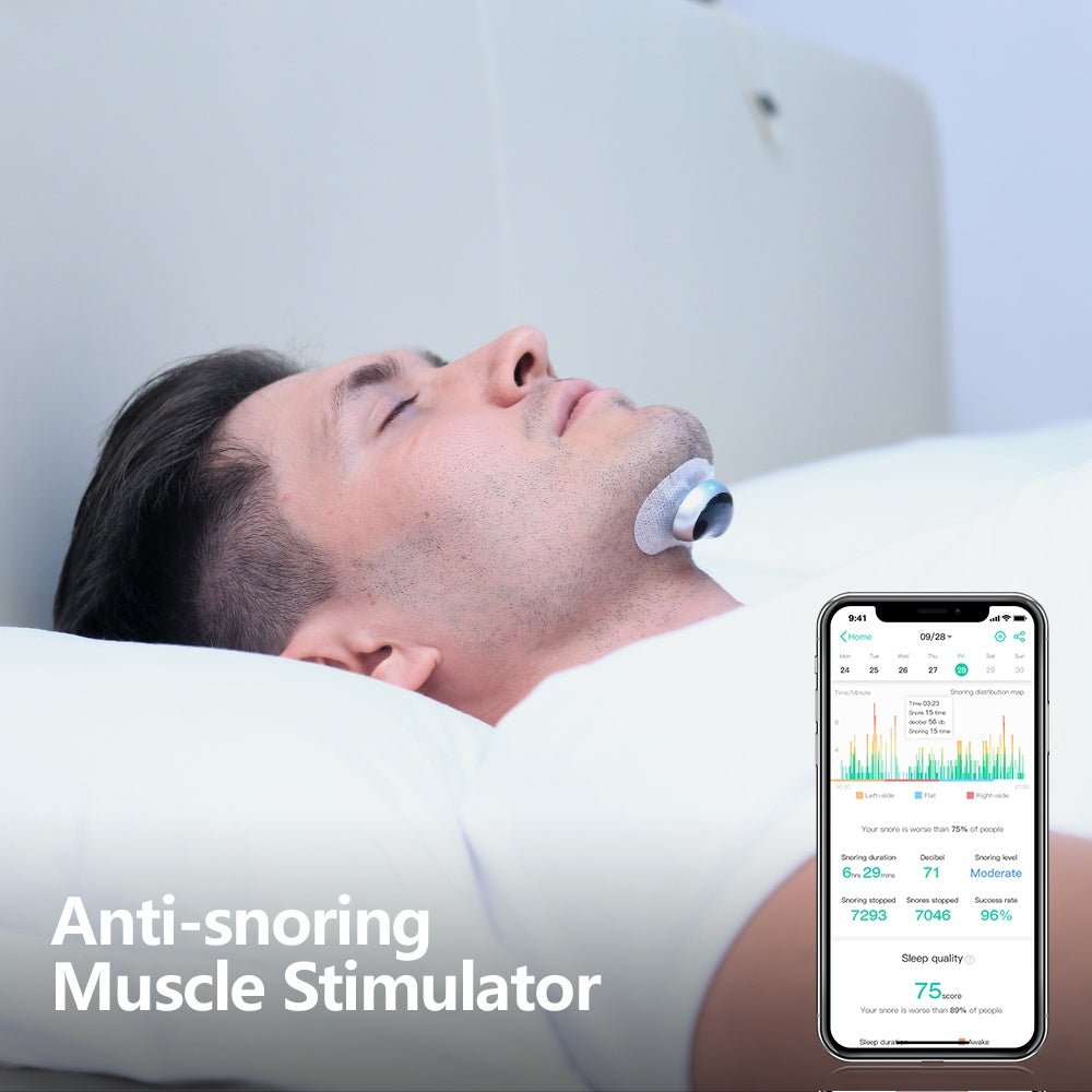 DreamSilence: Smart Anti-Snoring Device